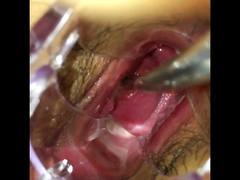 Japanese cervix playing